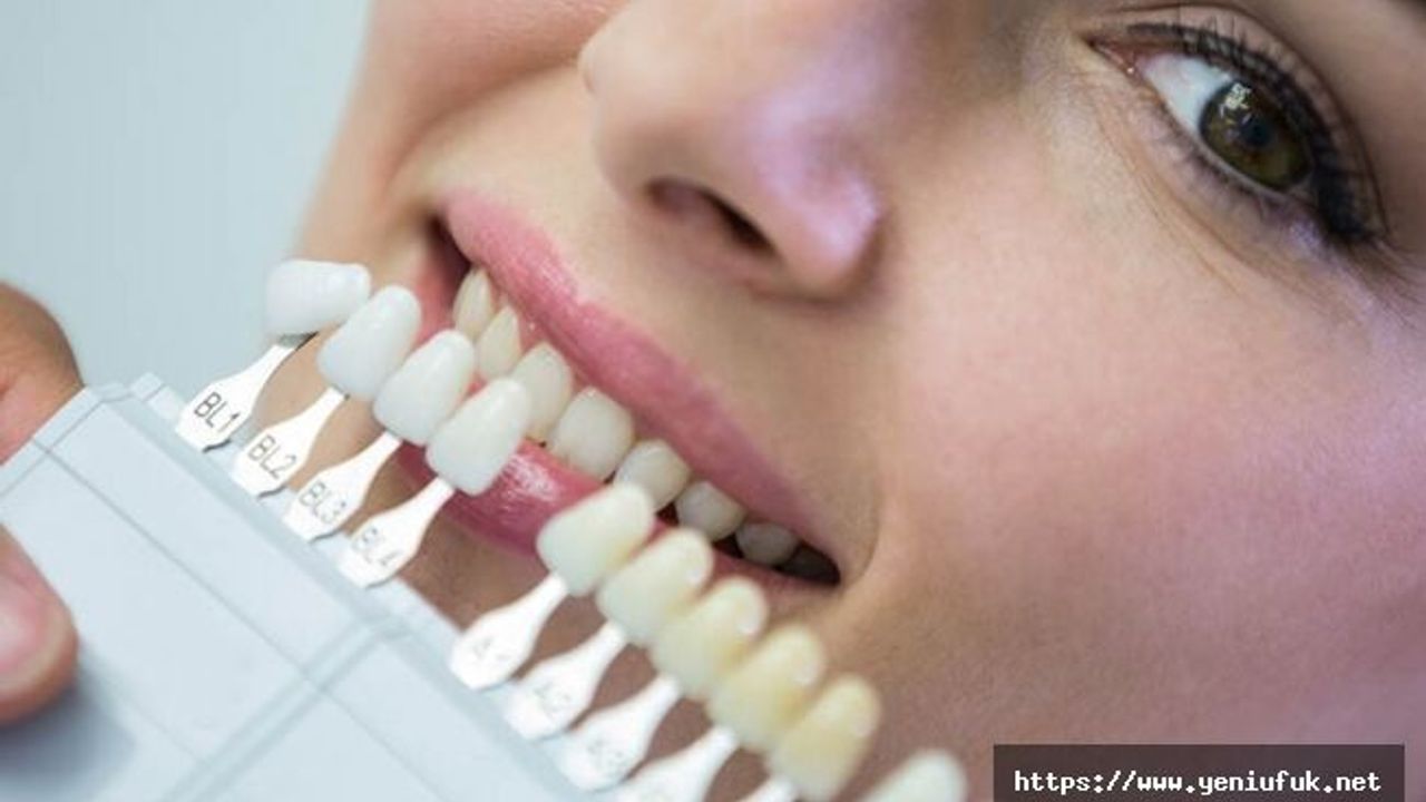 Yaprak Diş Nedir? Lamine Diş Nasıl Yapılır?