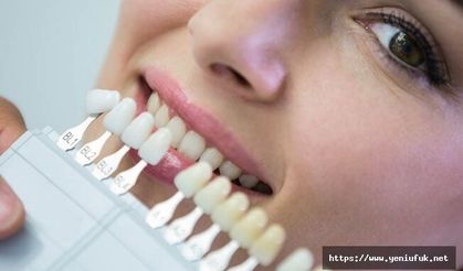 Yaprak Diş Nedir? Lamine Diş Nasıl Yapılır?